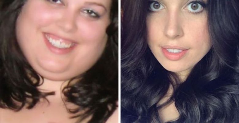 Amazing Before & After Pics Reveal How Weight Loss Affects Your Face