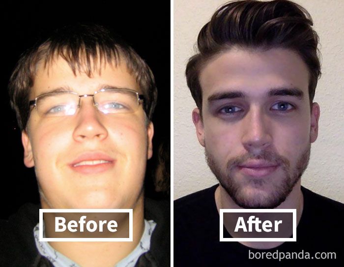 Amazing Before After Pics Reveal How Weight Loss Affects Your Face