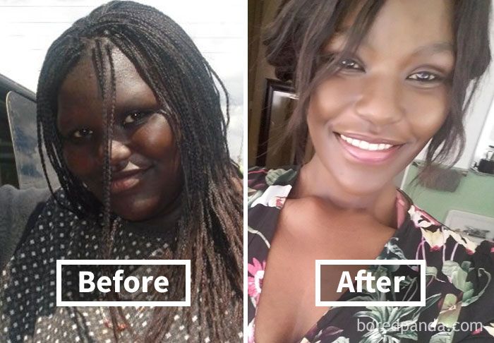 Amazing Before & After Pics Reveal How Weight Loss Affects Your Face