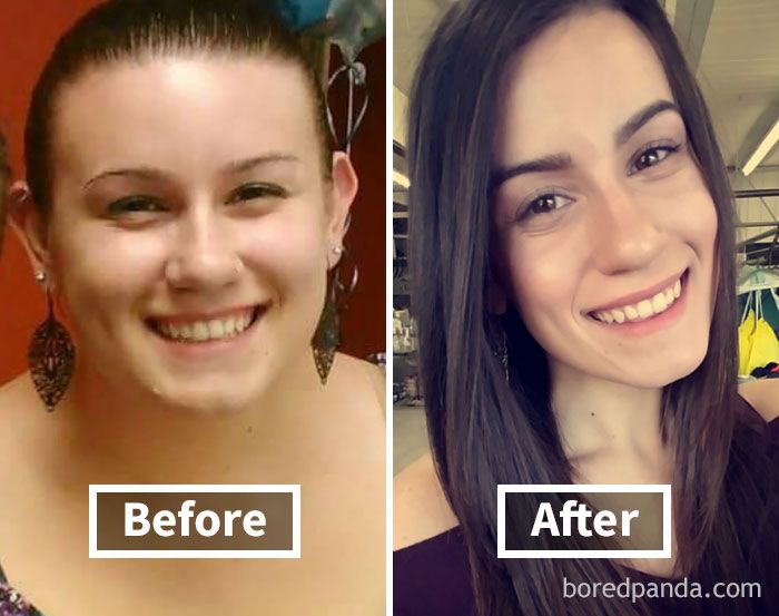 amazing-before-after-pics-reveal-how-weight-loss-affects-your-face