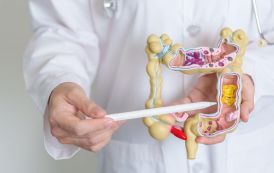 Colorectal Cancer: A Rising Health Concern Among Younger Adults