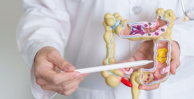 Colorectal Cancer: A Rising Health Concern Among Younger Adults