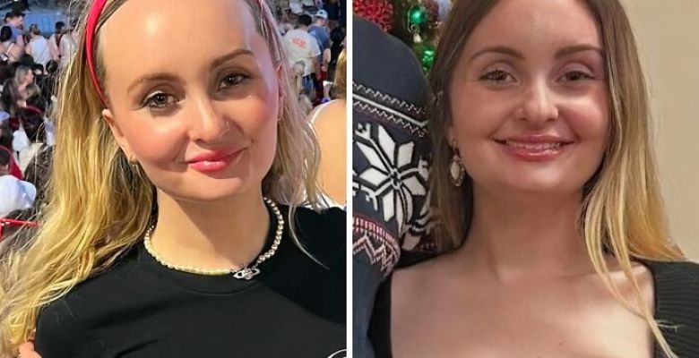 Cosmetic Procedures and Self-Confidence: Benefits, Risks, and Social Influence