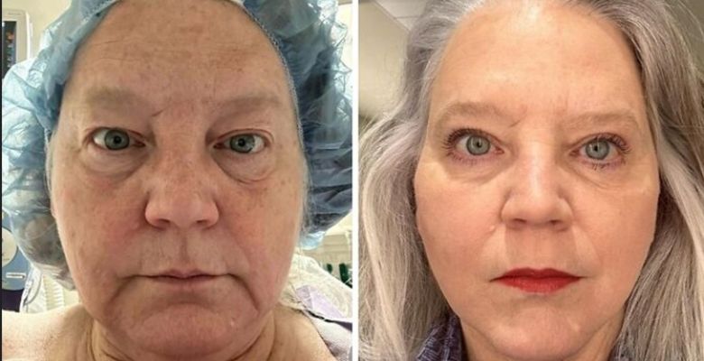 Healing Beyond the Mirror: How Successful Plastic Surgery Transforms the Human Mind